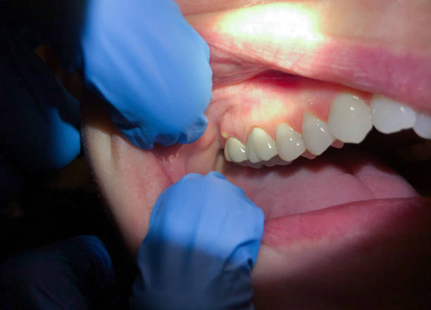 Best Broken or Cracked Tooth Emergency Dentist in Rockland, ME